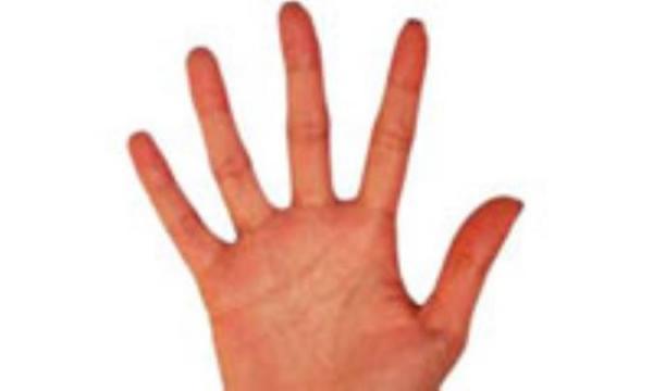 چرا پوستمان لک می شود؟